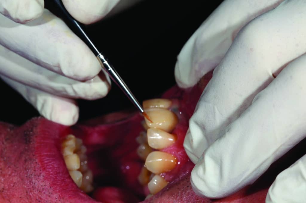 dentisterie esthétique maquillage en bouche