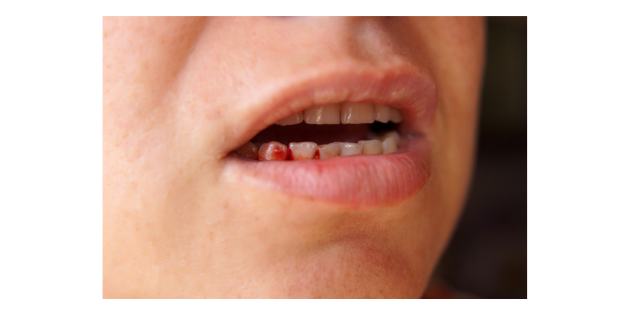 Les dentistes en première ligne pour alerter sur les violences familiales Les dentistes en première ligne pour alerter sur les violences familiales