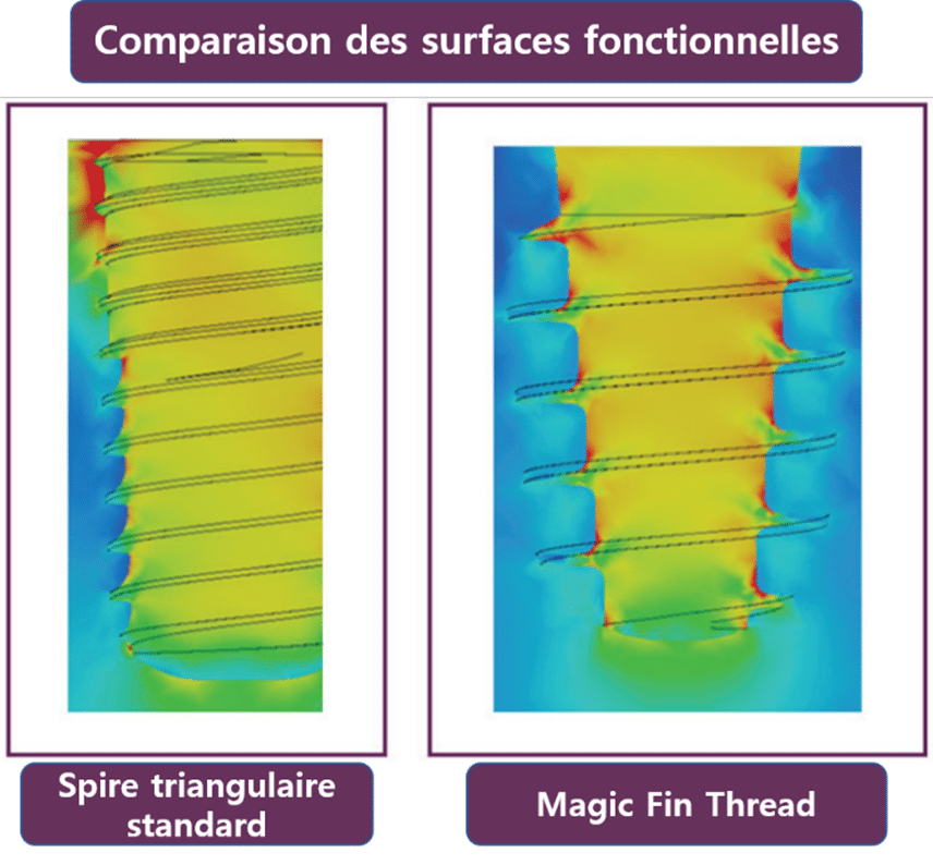 comparaison du système d'implant bone level