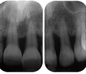 Image radiographique préopératoire