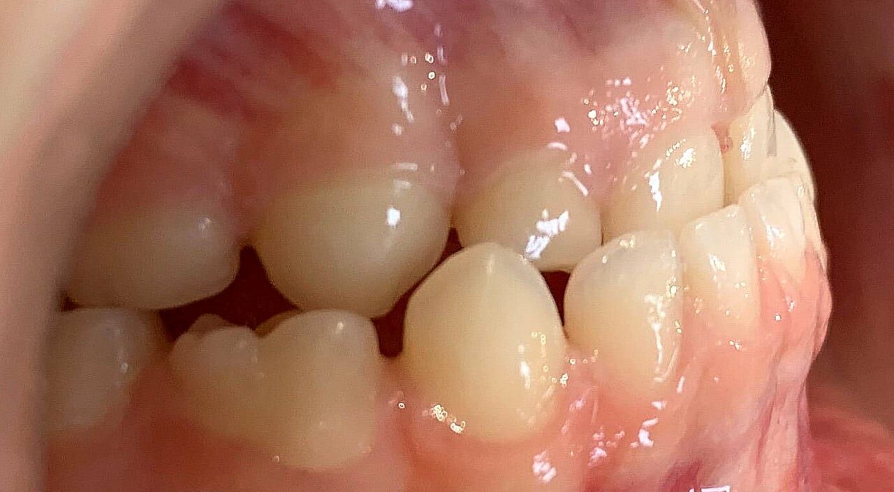 Orthodontie