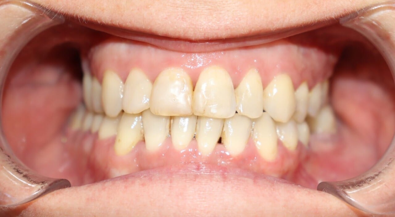 0718572992c867828572992c821485v